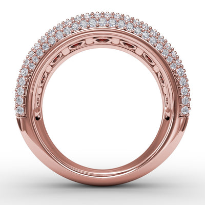 R1541R-14kt-Rose